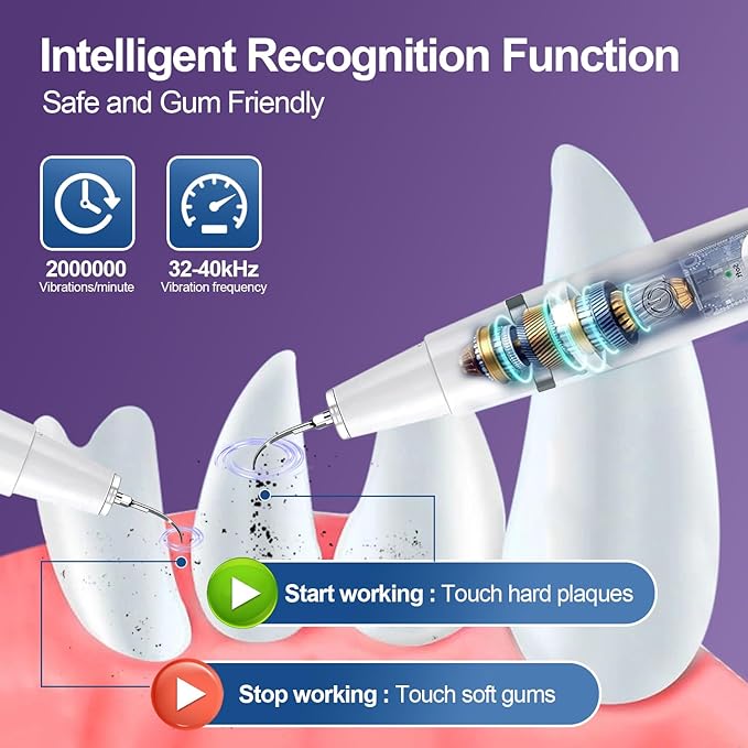 Dog Teeth Cleaning Kit-Dog Tooth Plaque Remover-Ultimate Pet Dental Care Kit - Ultrasonic Teeth Cleaner and Plaque Remover for Dogs | Complete Oral Hygiene Solution-White VVHOMIFE