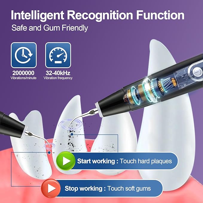 Dog Teeth Cleaning Kit-Dog Tooth Plaque Remover-Ultimate Pet Dental Care Kit - Ultrasonic Teeth Cleaner and Plaque Remover for Dogs | Complete Oral Hygiene Solution-Black VVHOMIFE